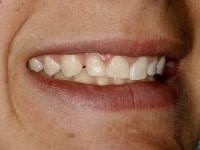 Konig Center for Cosmetic & Comprehensive Dentistry smile photos